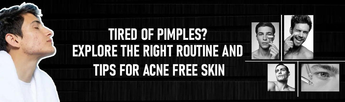 Tips for Acne Free Skin