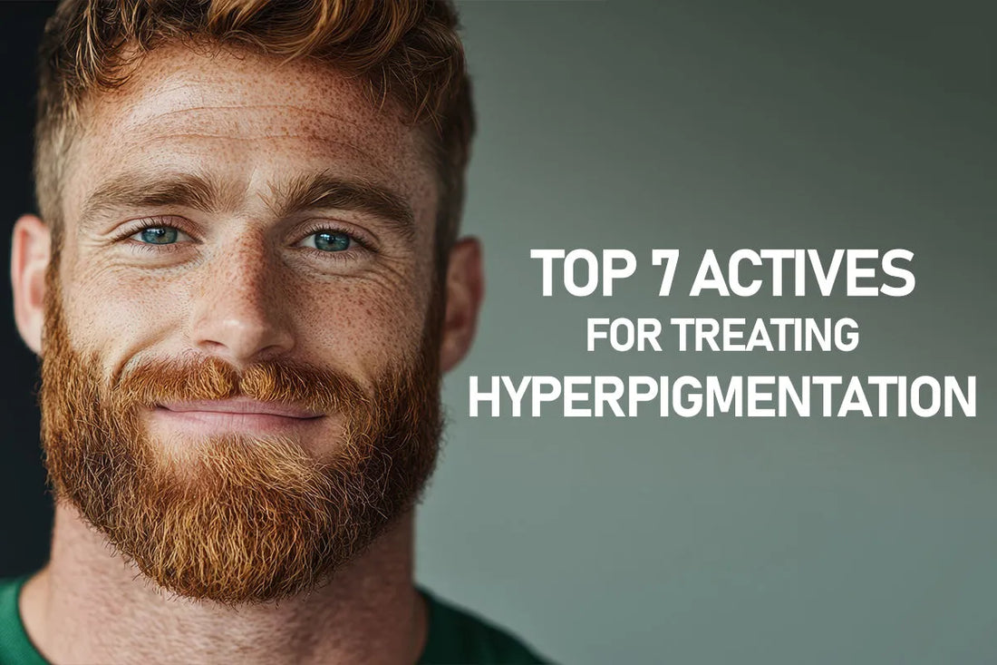 Top 7 Actives for Treating Hyperpigmentation - White Wolf India