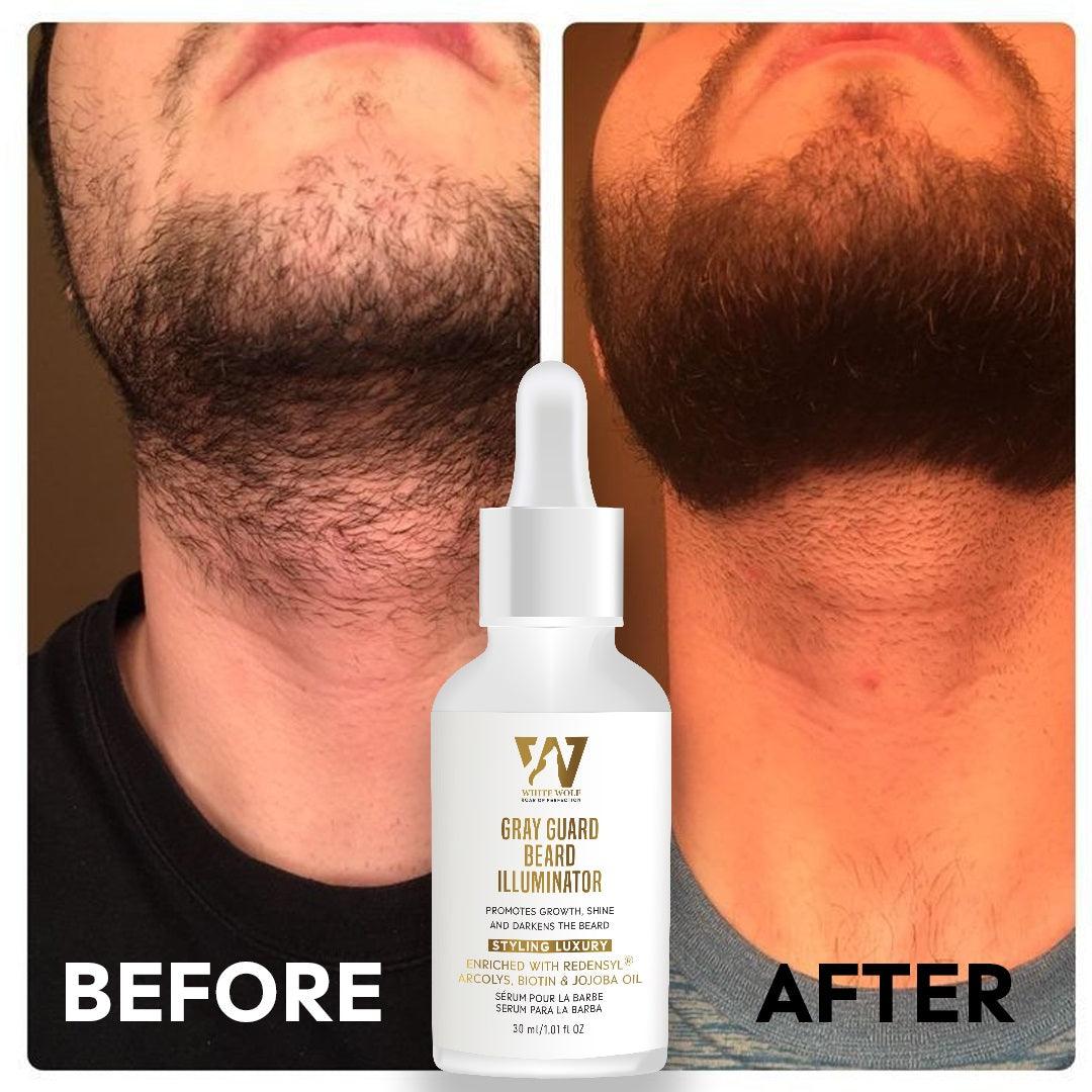 Results Beard Hair Growth Serum