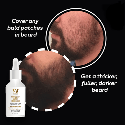 Beard Growth Serum results